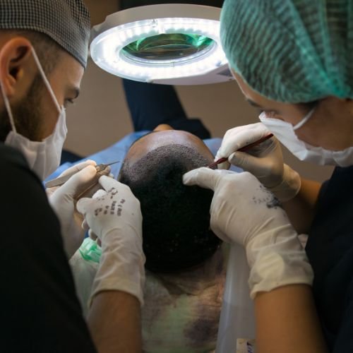 Hair Transplant